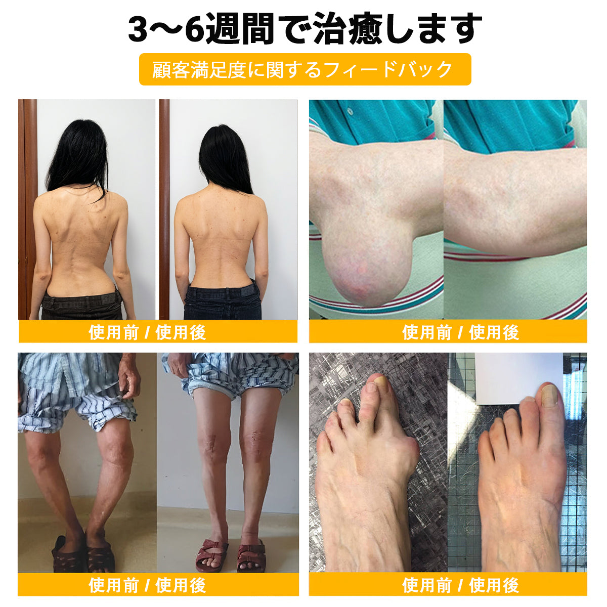 ハチ毒配合 痛み緩和・骨の治癒クリーム 🎊🎊（特に高齢者向け）