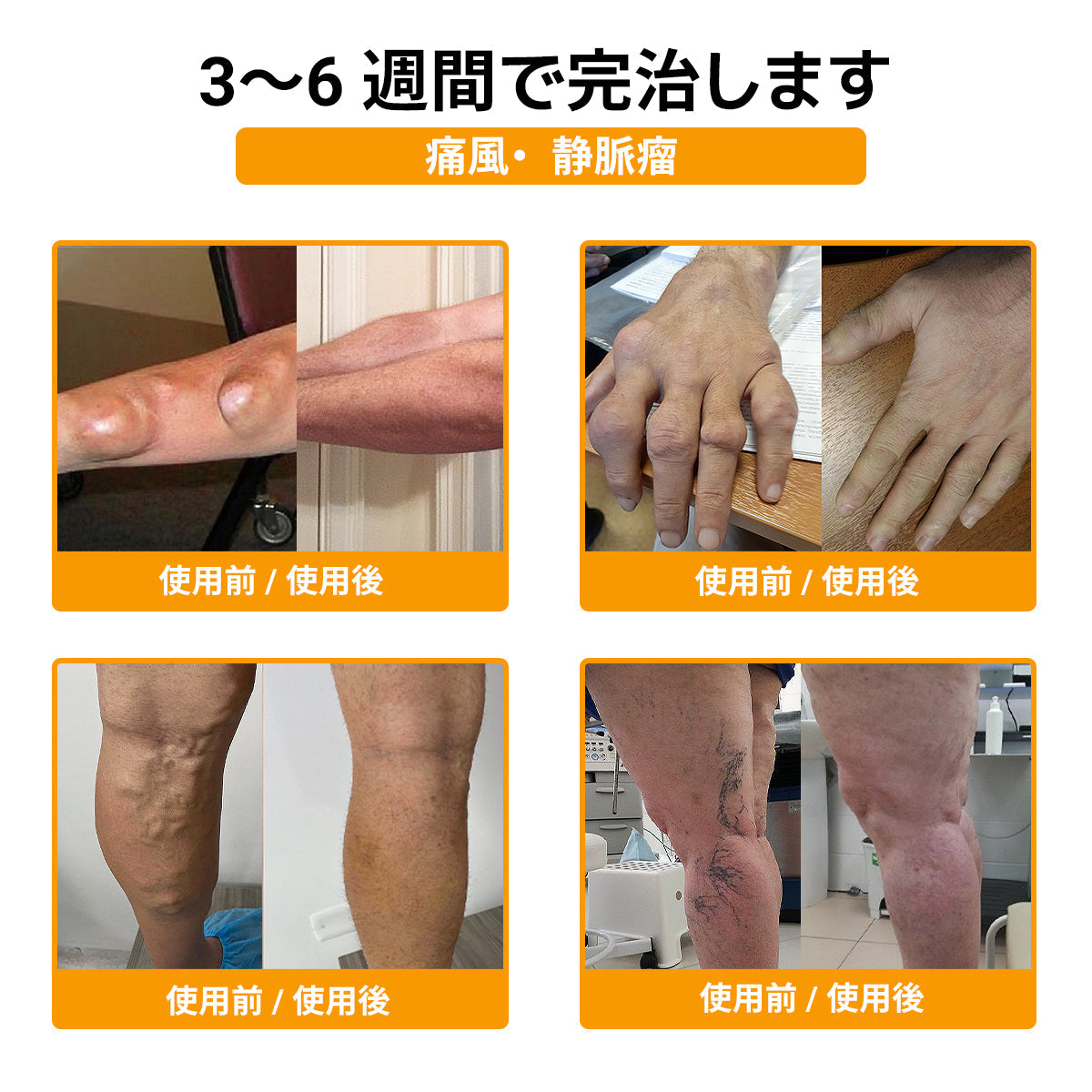 ハチ毒配合 痛み緩和・骨の治癒クリーム 🎊🎊（特に高齢者向け）