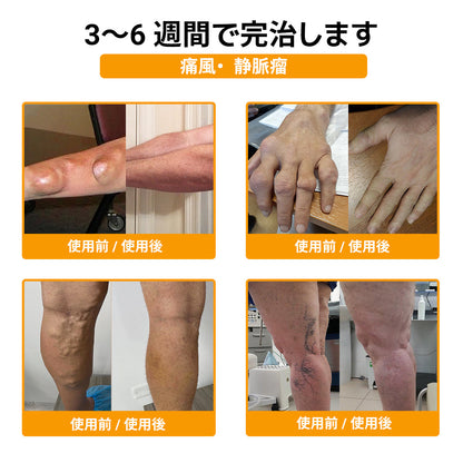 ハチ毒配合 痛み緩和・骨の治癒クリーム 🎊🎊（特に高齢者向け）
